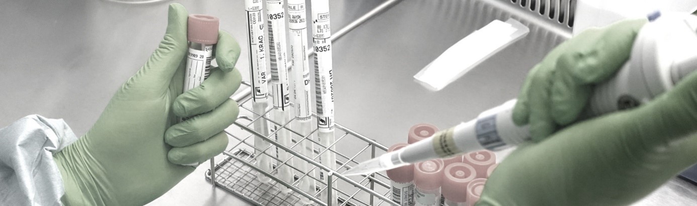 Laboratory samples in person's hand